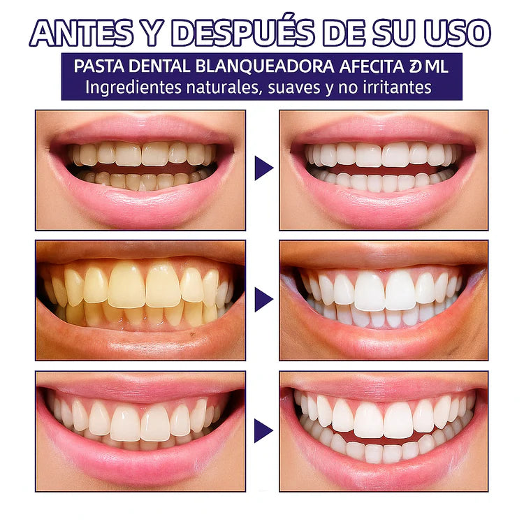 ESPUMA BLANQUEADORA DE DIENTES: OBSESSIVE