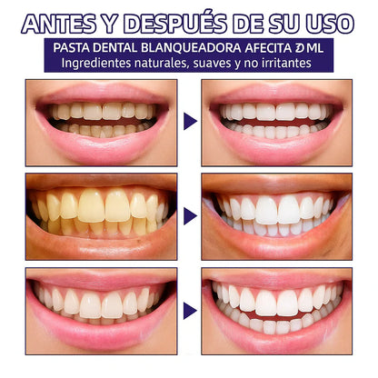 ESPUMA BLANQUEADORA DE DIENTES: OBSESSIVE