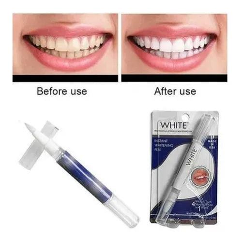 WhiteGlow™ – Blanqueador Dental Instantáneo