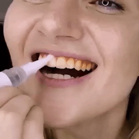 WhiteGlow™ – Blanqueador Dental Instantáneo