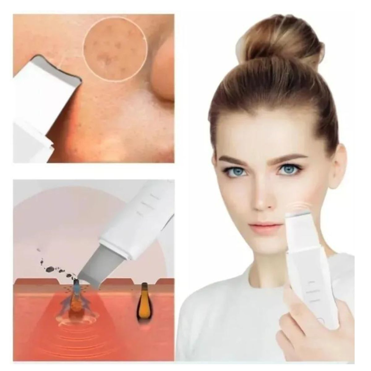 DermaLift™ – La Revolución en Cuidado Facial Está en Tus Manos